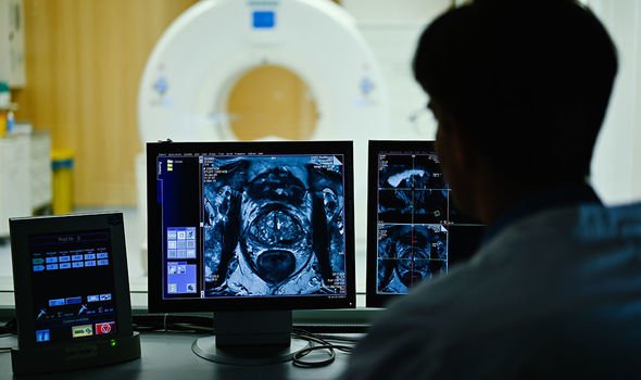 Scan for prostate cancer Scan for prostate cancer