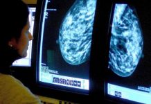 One million women miss vital breast cancer check because of pandemic | UK | News (Reports)