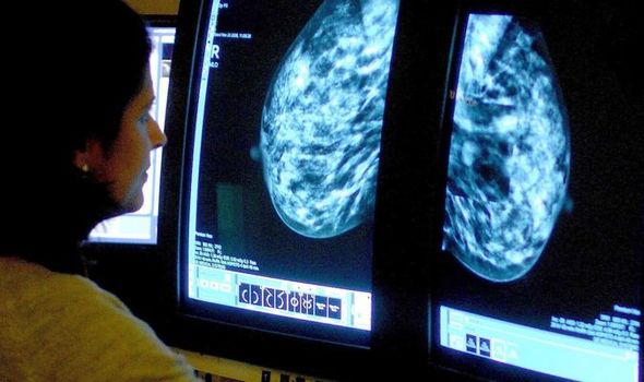 A consultant analysing a mammogram