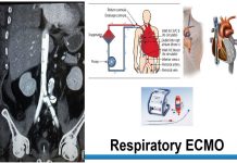 Second British-Turkmen webinar on COVID-19