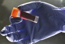 Health chiefs approve ‘game-changing’ treatment for blood cancer | UK | News (Reports)