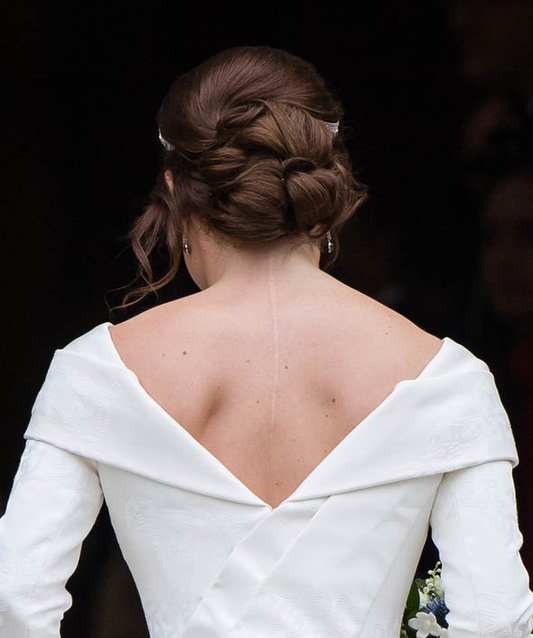 princess eugenie news royal patronage scoliosis association uk royal news