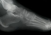 Medical device supplier resolves CMA concerns