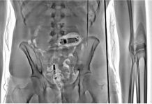 X-ray scanners stop over 1,000 illegal items entering prisons